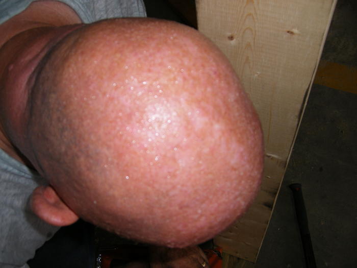 Dad sweating